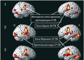 Практическая неврология - Кадыков А